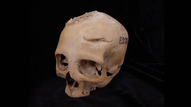 antico egitto cranio