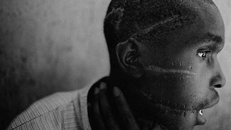 Foto del giorno: le cicatrici del genocidio in Ruanda